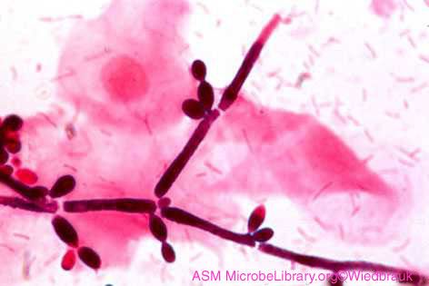 Candida svampar (candida) är patogener av candidiasis